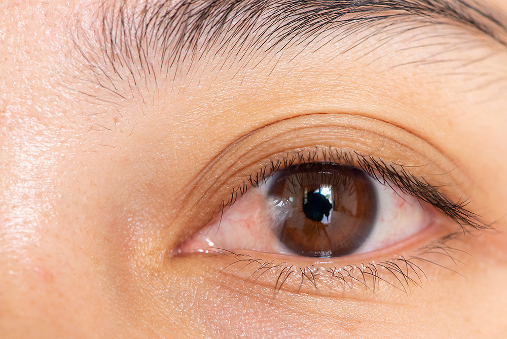 pterygium treatment Adelaide pterygium treatment pterygium surgery pterygium removal