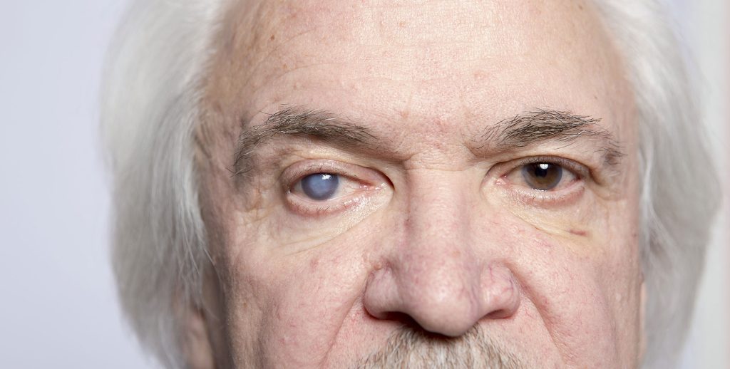 glaucoma vs cataracts, cataract symptoms, glaucoma symptoms, optic nerve damage