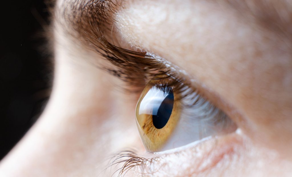 keratoconus symptoms, early signs of keratoconus, distorted vision, frequent prescription changes
