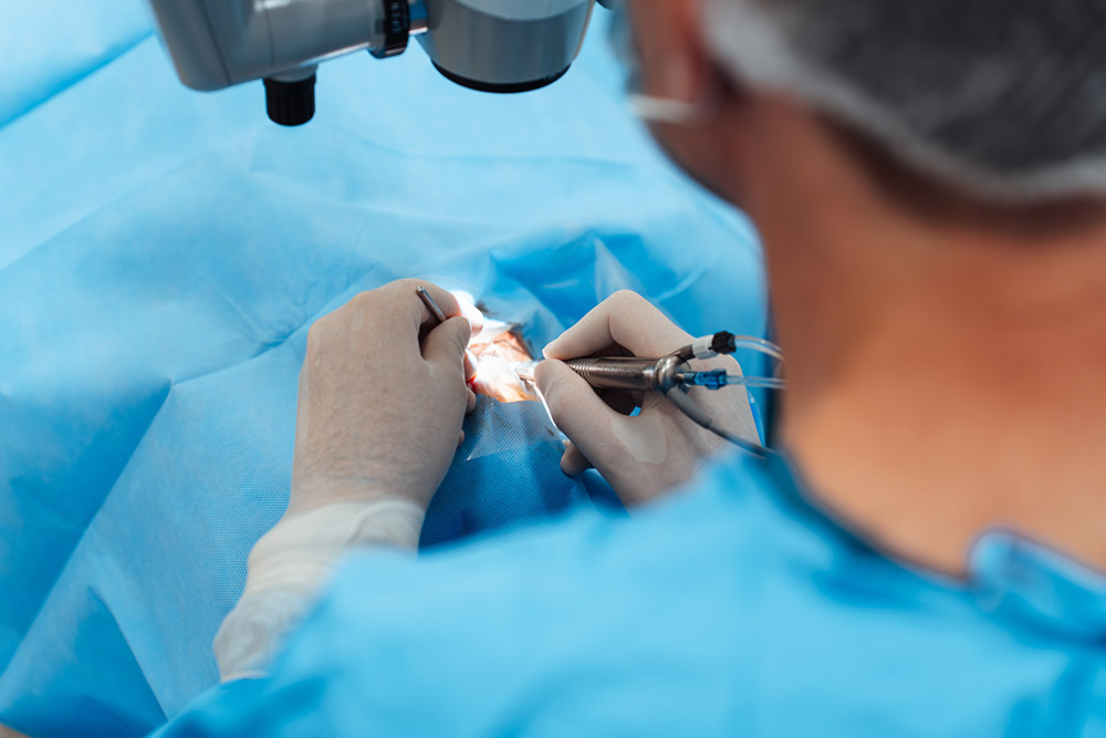 how long between cataract surgery on each eye, separate cataract procedures, second-eye cataract surgery, cataract treatment planning