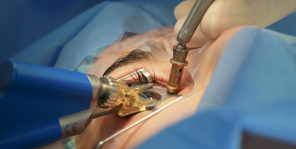 safety of laser eye surgery