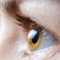 keratoconus symptoms, early signs of keratoconus, distorted vision, frequent prescription changes