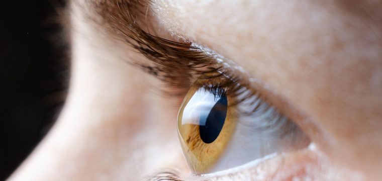 keratoconus symptoms, early signs of keratoconus, distorted vision, frequent prescription changes