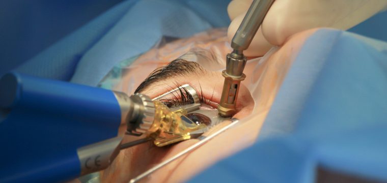 safety of laser eye surgery